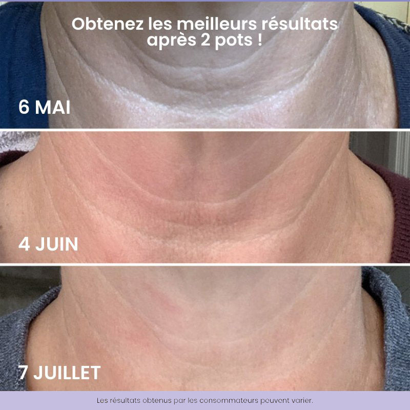 Crème raffermissante pour la peau